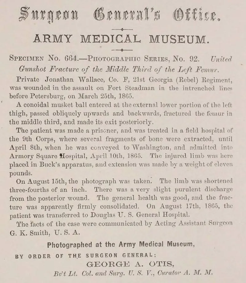 Civil War: Surgeon General Photos & Surgical Cases - Image 3