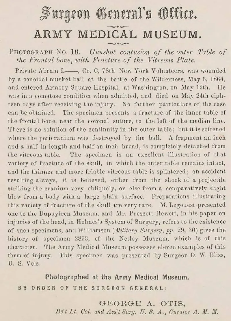 Civil War: Surgeon General Photos & Surgical Cases - Image 5