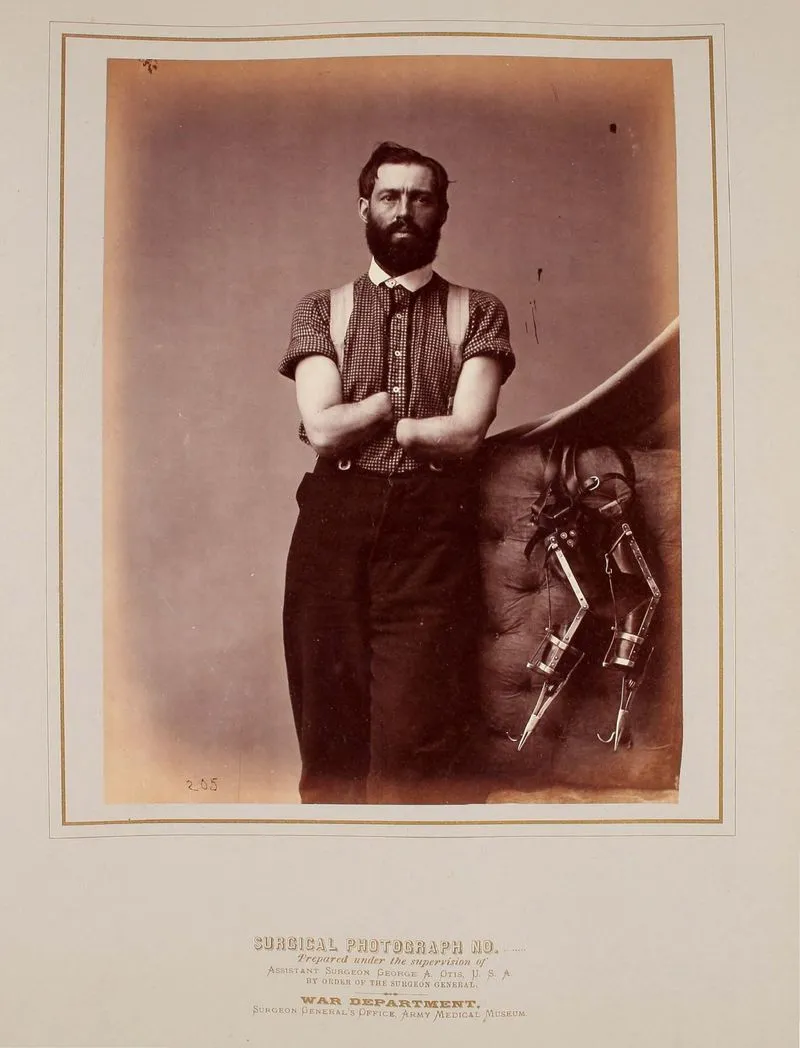 Civil War: Surgeon General Photos & Surgical Cases - Image 6