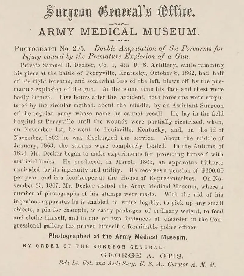 Civil War: Surgeon General Photos & Surgical Cases - Image 7